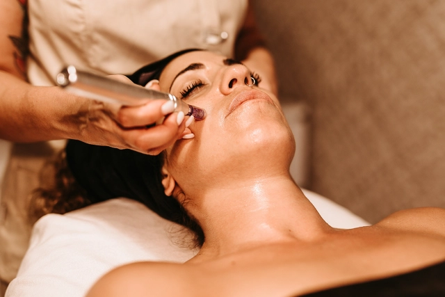 microneedling cascante