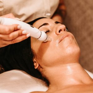 tratamiento microneedling en cascante